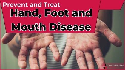 A rash on the hands is characteristic of hand, foot, and mouth disease.